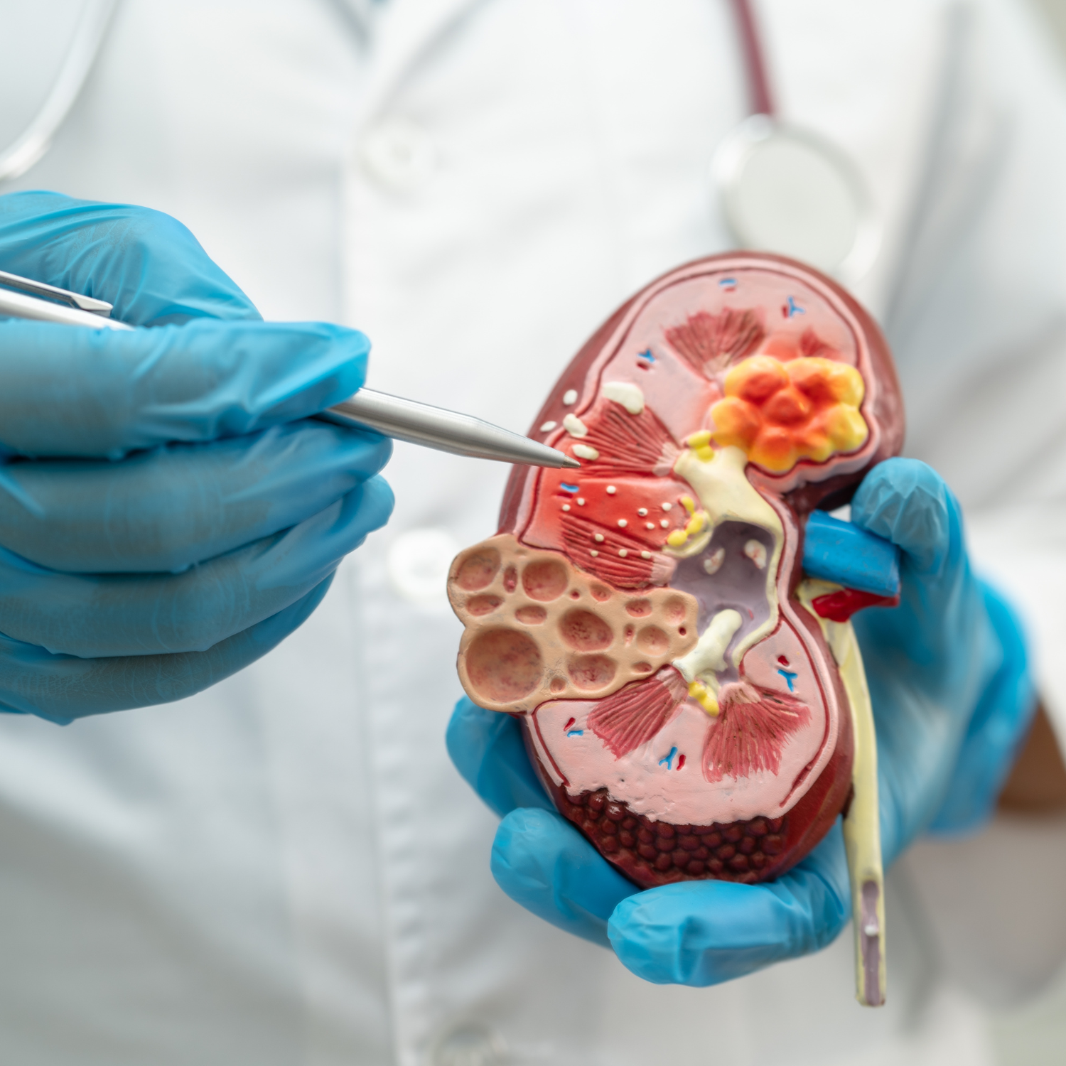 Pathologies obstructives de l'infirmier